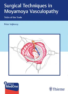 Vajkoczy | Vajkoczy, P: Surgical Techniques in Moyamoya Vasculopathy | Medienkombination | sack.de
