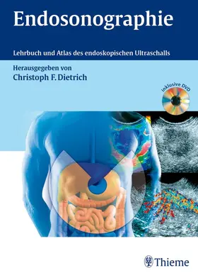 Dietrich |  Endosonographie | Buch |  Sack Fachmedien