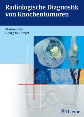 Uhl / Herget | Radiologische Diagnostik von Knochentumoren | Buch | 978-3-13-145661-8 | sack.de