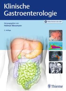 Messmann | Klinische Gastroenterologie | Medienkombination | 978-3-13-147252-6 | sack.de