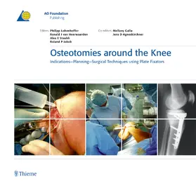 Lobenhoffer / Heerwaarden / van Heerwaarden |  Osteotomies around the Knee | Buch |  Sack Fachmedien