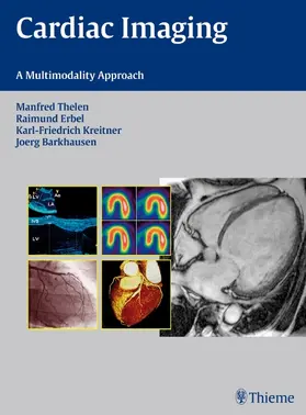 Thelen / Barkhausen / Erbel | Cardiac Imaging | E-Book | sack.de