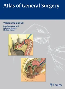 Schumpelick |  Atlas of General  Surgery | eBook | Sack Fachmedien