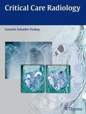 Schaefer-Prokop |  Critical Care Radiology | Buch |  Sack Fachmedien