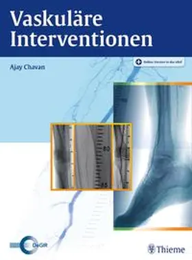 Chavan | Vaskuläre Interventionen | Medienkombination | 978-3-13-153201-5 | www.sack.de