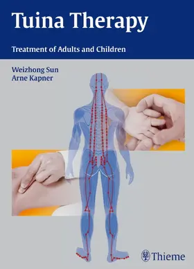Kapner / Sun |  Tuina Therapy | Buch |  Sack Fachmedien