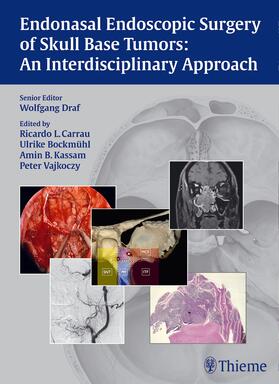 Draf / Carrau / Bockmühl |  Draf, W: Endonasal Endoscopic Surgery of Skull Base Tumors: | Buch |  Sack Fachmedien