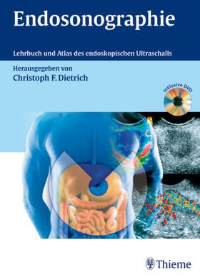 Dietrich |  Endosonographie | eBook | Sack Fachmedien