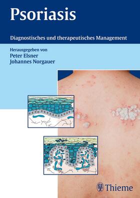 Elsner / Norgauer | Psoriasis | E-Book | sack.de