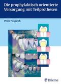 Pospiech |  Die prophylaktisch orientierte Versorgung mit Teilprothesen | eBook | Sack Fachmedien