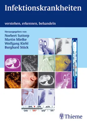 Suttorp / Mielke / Kiehl |  Infektionskrankheiten | eBook | Sack Fachmedien