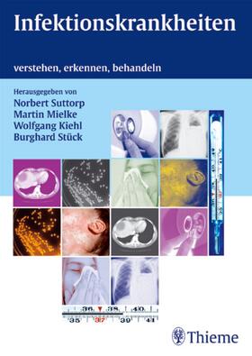 Suttorp / Mielke / Kiehl | Infektionskrankheiten | E-Book | sack.de