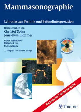 Sohn / Blohmer |  Mammasonographie | eBook | Sack Fachmedien