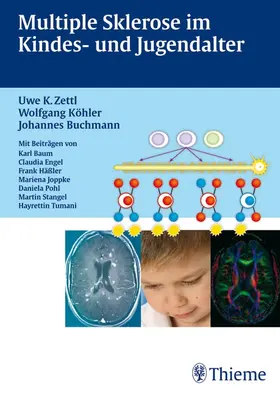 Buchmann / Köhler / Zettl |  Multiple Sklerose im Kinder- und Jugendalter Mit Beiträgen von Karl Braun, Clau | eBook | Sack Fachmedien