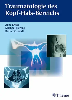Ernst / Herzog / Seidl |  Traumatologie des Kopf-Hals-Bereichs | eBook | Sack Fachmedien