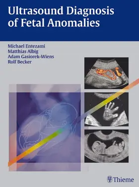 Entezami / Albig / Gasiorek-Wiens |  Ultrasound Diagnosis of Fetal Anomalies | eBook | Sack Fachmedien