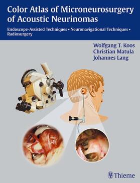 Koos / Matula / Lang | Color Atlas of Microsurgery of Acoustic Neurinomas | E-Book | sack.de