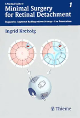 Kreissig |  A Practical Guide to Minimal Surgery for Retinal Detachment, Vol. 1 | eBook | Sack Fachmedien