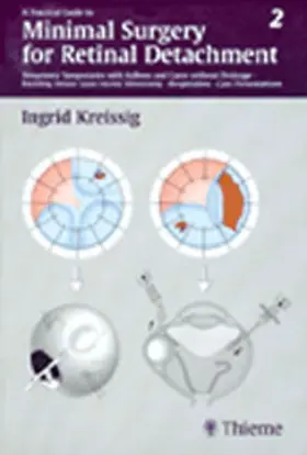 Kreissig | A Practical Guide to Minimal Surgery for Retinal Detachment, Vol. 2 | E-Book | www.sack.de