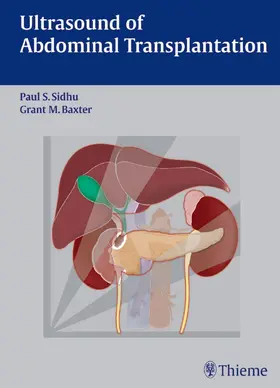Sidhu / Baxter | Ultrasound of Abdominal Transplantation | E-Book | www.sack.de