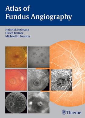 Heimann / Foerster / Kellner | Atlas of Fundus Angiography | E-Book | sack.de