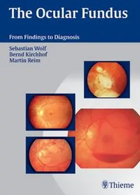 Wolf / Kirchhof / Reim |  The Ocular Fundus | eBook | Sack Fachmedien