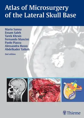 Sanna / Khrais / Mancini |  Atlas of Microsurgery of the Lateral Skull Base | eBook | Sack Fachmedien