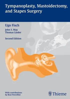 Fisch / May / Porcellini | Tympanoplasty, Mastoidectomy, and Stapes Surgery | E-Book | www.sack.de