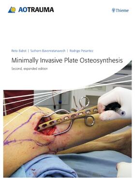 Babst / Bavonratanavech / Pesantez | Minimally Invasive Plate Osteosynthesis | E-Book | sack.de