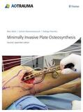 Babst / Bavonratanavech / Pesantez |  Minimally Invasive Plate Osteosynthesis | eBook | Sack Fachmedien
