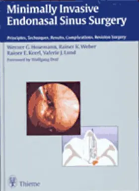 Hosemann / Lund / Weber |  Minimally Invasive Endonasal Sinus Surgery | eBook | Sack Fachmedien