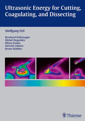 Feil / Dallemagne / Degueldre | Ultrasonic Energy for Cutting, Coagulating, and Dissecting | E-Book | www.sack.de