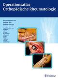 Sell / Rehart |  Operationsatlas Orthopädische Rheumatologie | eBook | Sack Fachmedien