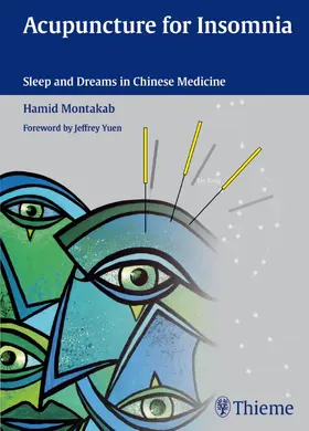 Montakab |  Acupuncture for Insomnia | eBook | Sack Fachmedien