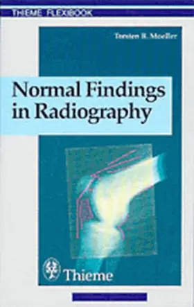 Moeller |  Normal Findings in Radiography | eBook | Sack Fachmedien