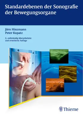 Hinzmann / Kupatz | Standardebenen der Sonografie der Bewegungsorgane | E-Book | sack.de