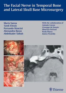 Sanna / Khrais / Mancini |  The Facial Nerve in Temporal Bone and Lateral Skull Base Microsurgery | eBook | Sack Fachmedien