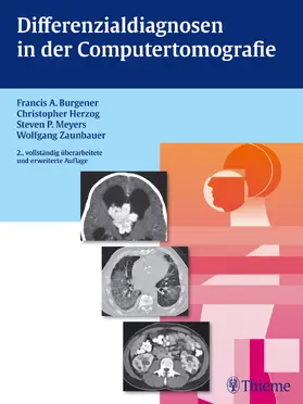 Burgener / Herzog / Meyers | Differenzialdiagnosen in der Computertomografie | E-Book | www.sack.de