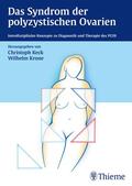 Keck / Krone |  Das Syndrom der polyzystischen Ovarien | eBook | Sack Fachmedien