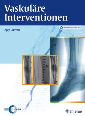 Chavan |  Vaskuläre Interventionen | eBook | Sack Fachmedien