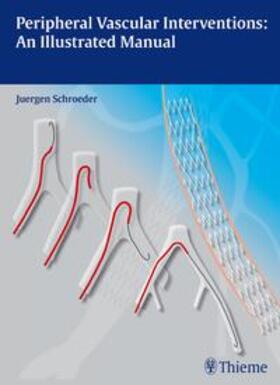 Schröder | Schröder, J: Peripheral Vascular Interventions | Buch | 978-3-13-169751-6 | sack.de
