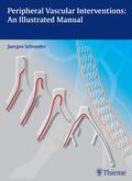Schröder |  Peripheral Vascular Interventions: An Illustrated Manual | eBook | Sack Fachmedien