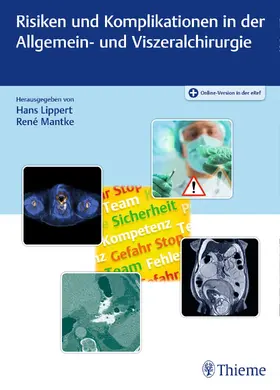 Lippert / Mantke |  Risiken und Komplikationen in der Allgemein- und Viszeralchirurgie | Buch |  Sack Fachmedien