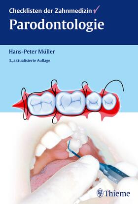 Müller | Checklisten der Zahnmedizin Parodontologie | E-Book | sack.de