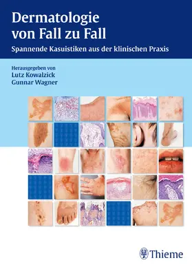 Kowalzick / Wagner |  Dermatologie von Fall zu Fall | eBook | Sack Fachmedien