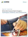 Haertl / Korge |  Minimally Invasive Spine Surgery - Techniques, Evidence, and Controversies | eBook | Sack Fachmedien