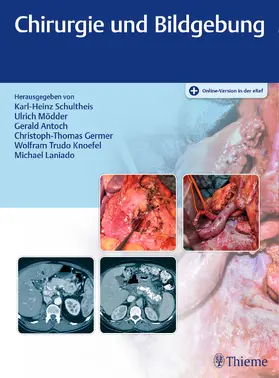Schultheis / Mödder / Antoch |  Chirurgie und Bildgebung | Buch |  Sack Fachmedien