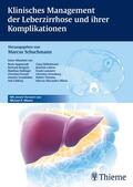 Schuchmann |  Klinisches Management der Leberzirrhose und ihrer Komplikationen | Buch |  Sack Fachmedien