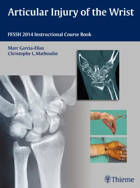 Garcia-Elias / Mathoulin |  Articular Injury of the Wrist | eBook | Sack Fachmedien