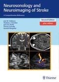 Valdueza / Schreiber / Röhl |  Neurosonology and Neuroimaging of Stroke | eBook | Sack Fachmedien